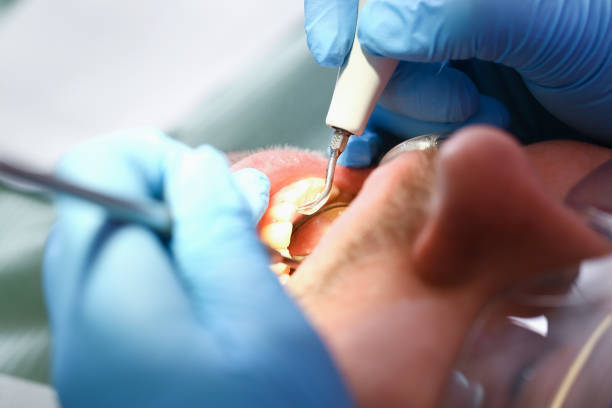 Best Emergency Broken Tooth Repair in North Belle Vernon, PA