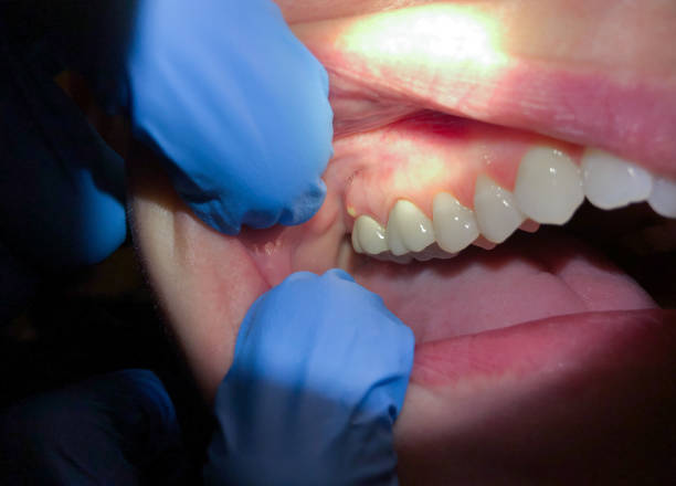 Best Emergency Treatment for Toothache in North Belle Vernon, PA