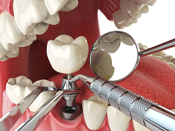 Best Emergency Dental Care for Trauma or Injury in North Belle Vernon, PA